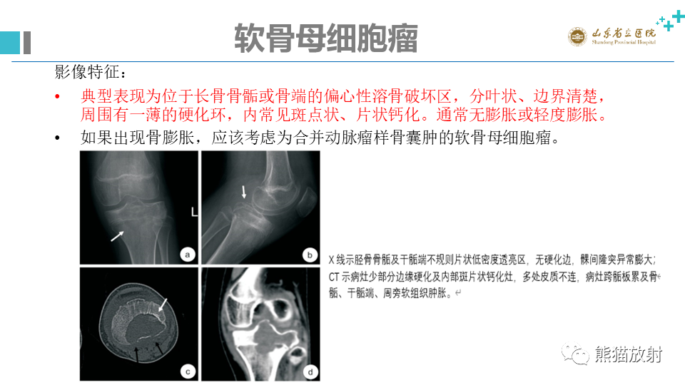 影像PPT - 【病例】股骨远端动脉瘤样骨囊肿ABC VS 软骨母细胞瘤-13