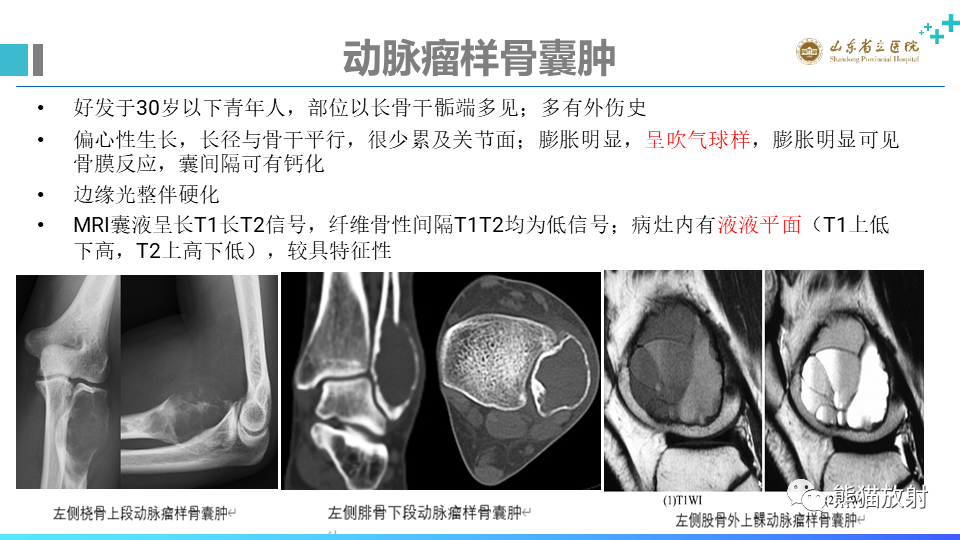 影像PPT - 【病例】股骨远端动脉瘤样骨囊肿ABC VS 软骨母细胞瘤-17