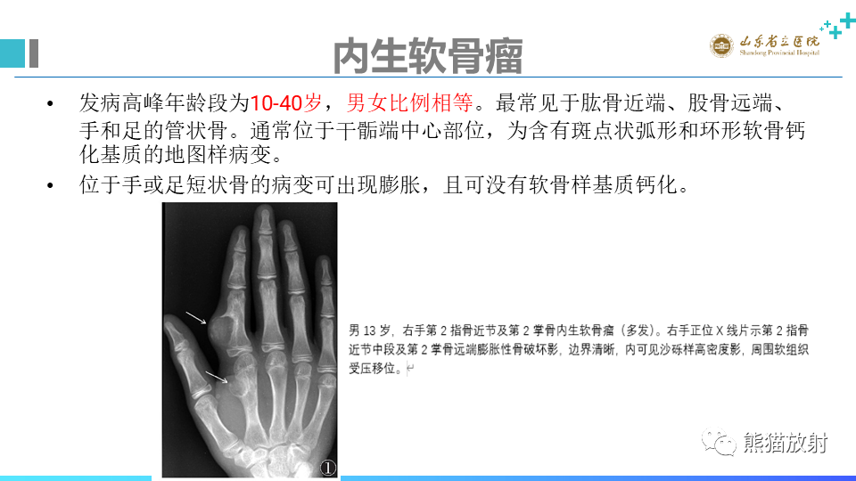 影像PPT - 【病例】股骨远端动脉瘤样骨囊肿ABC VS 软骨母细胞瘤-18
