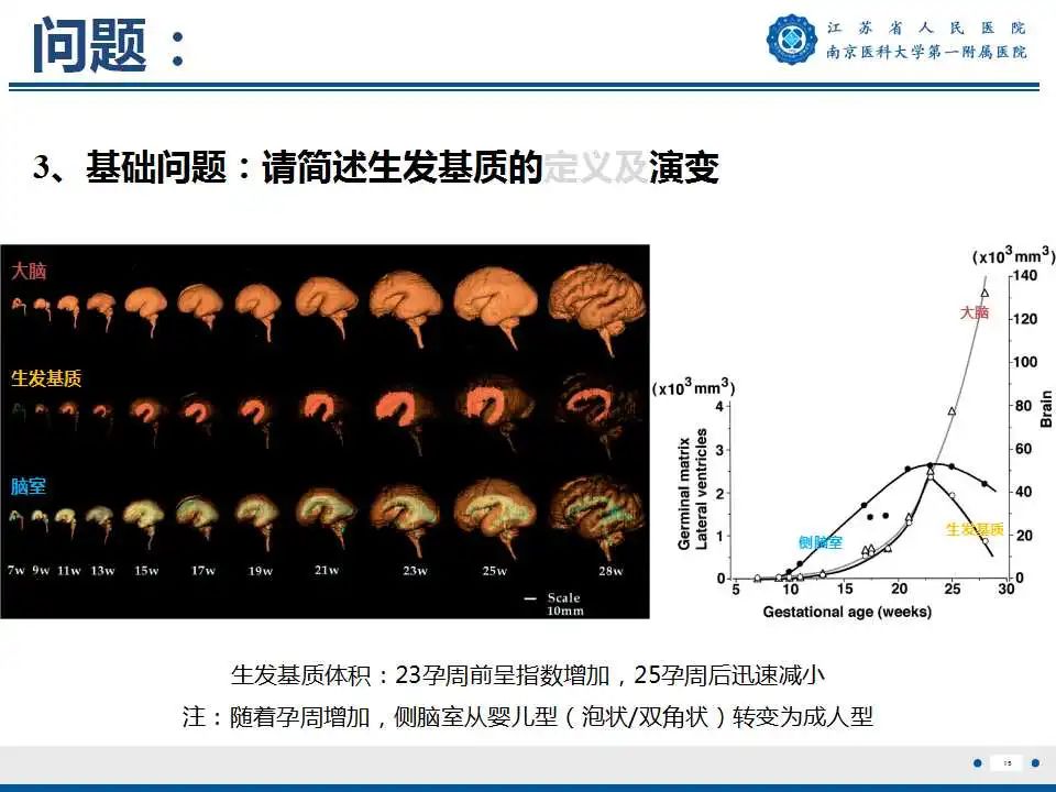 影像PPT - 【PPT】生发基质-脑室内出血-16