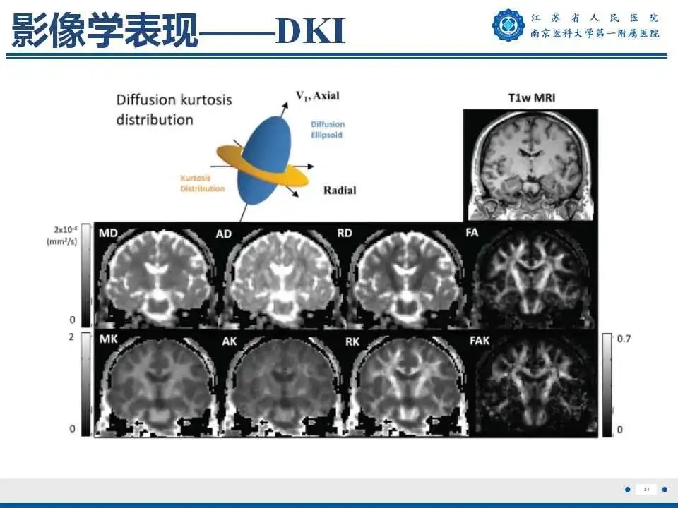 影像PPT - 【PPT】生发基质-脑室内出血-32