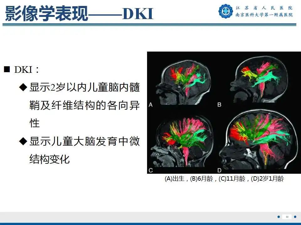 影像PPT - 【PPT】生发基质-脑室内出血-33