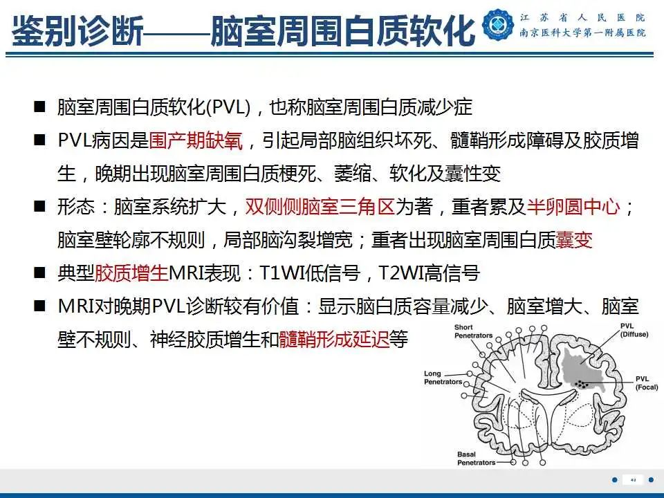 影像PPT - 【PPT】生发基质-脑室内出血-41