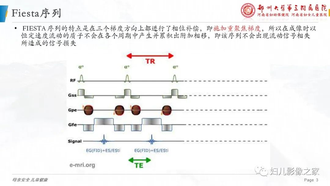 影像PPT - 【PPT】3D fiesta序列在胎儿脊柱中的应用-3