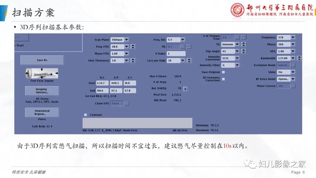 影像PPT - 【PPT】3D fiesta序列在胎儿脊柱中的应用-6