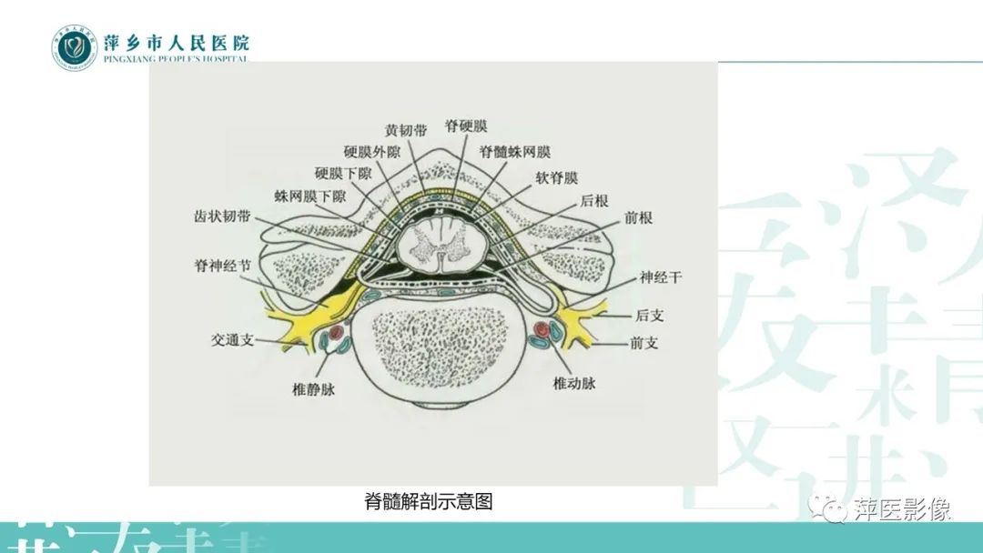 影像PPT - 【PPT】髓外硬膜内肿瘤-4