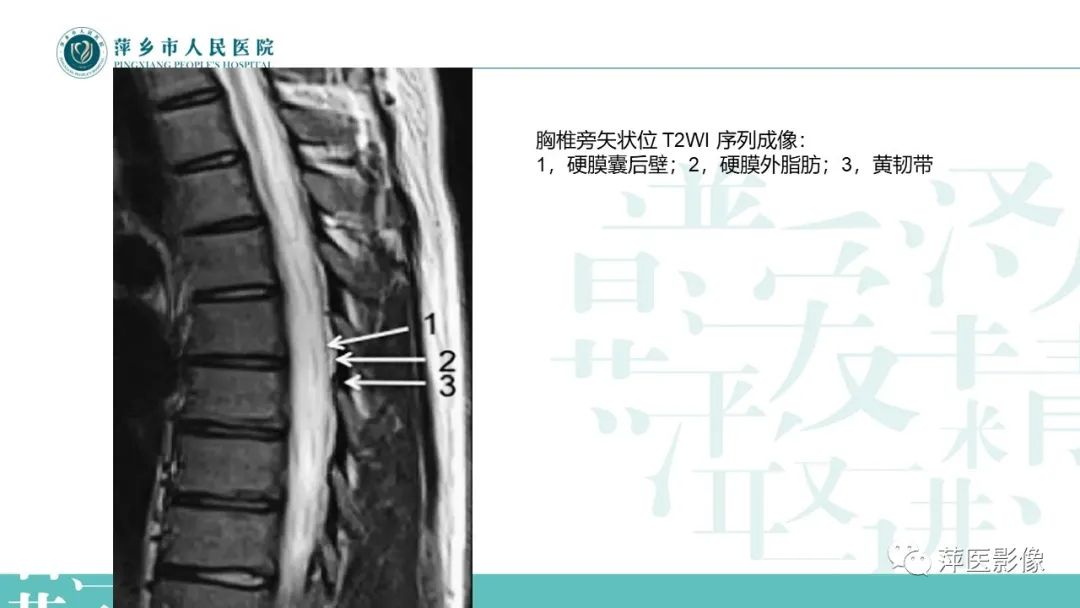 影像PPT - 【PPT】髓外硬膜内肿瘤-6