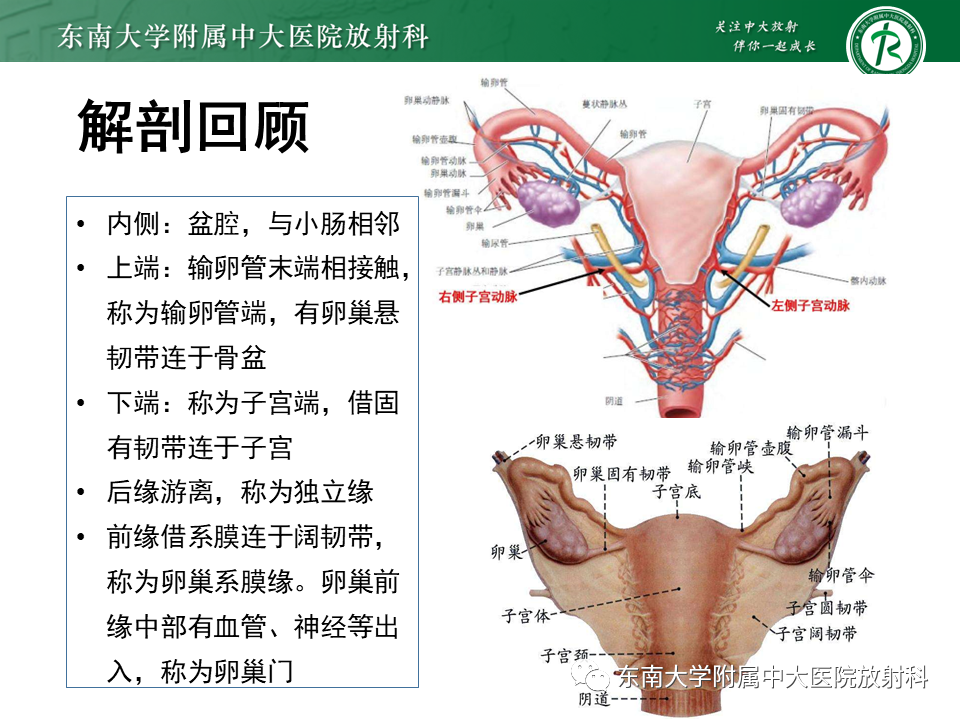 影像PPT - 【PPT】卵巢子宫内膜样癌-5