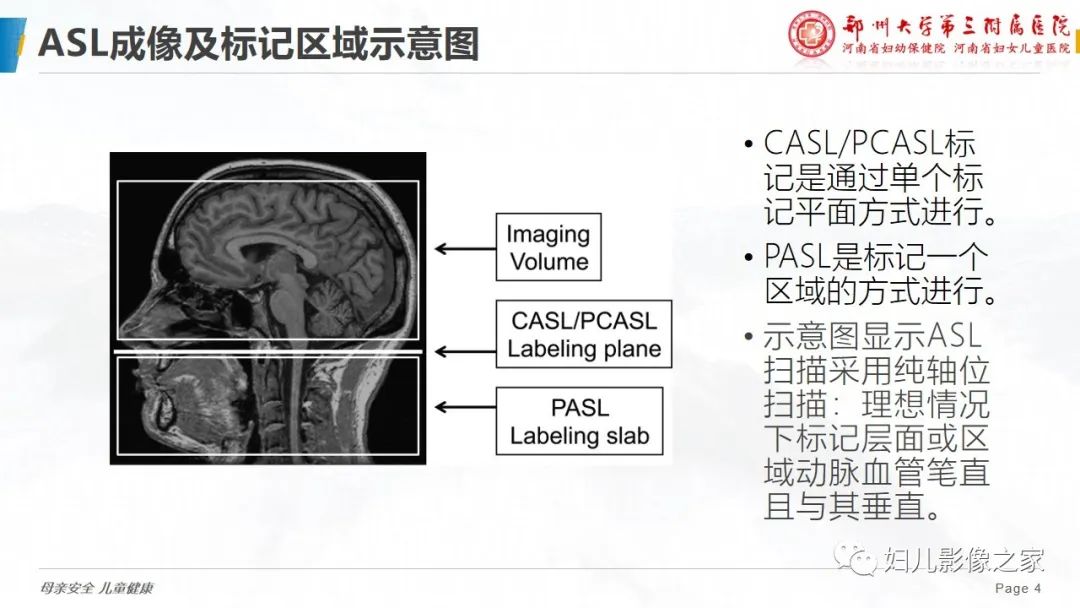 影像PPT - 【PPT】ASL技术—专家共识-4