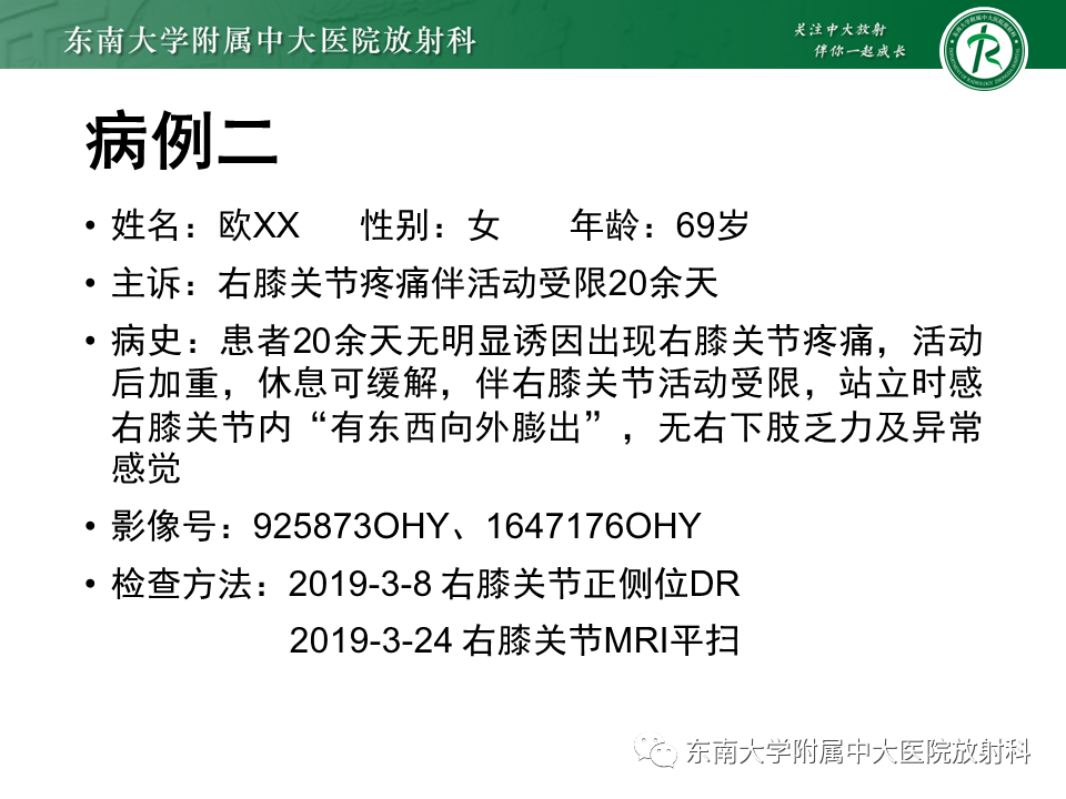 影像PPT - 【PPT】膝关节腱鞘巨细胞瘤-12