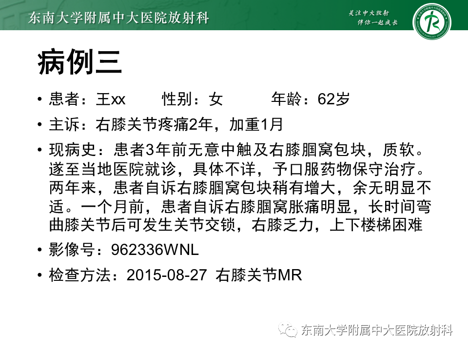 影像PPT - 【PPT】膝关节腱鞘巨细胞瘤-20