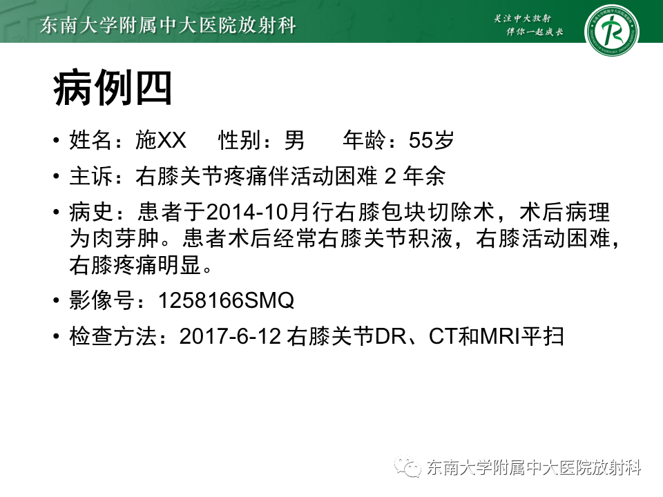 影像PPT - 【PPT】膝关节腱鞘巨细胞瘤-25