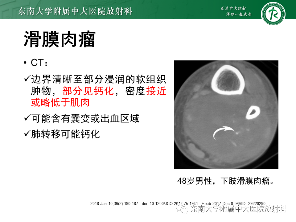 影像PPT - 【PPT】膝关节腱鞘巨细胞瘤-30