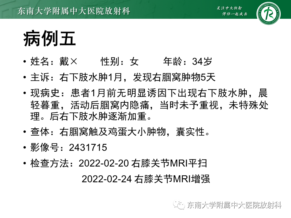 影像PPT - 【PPT】膝关节腱鞘巨细胞瘤-32