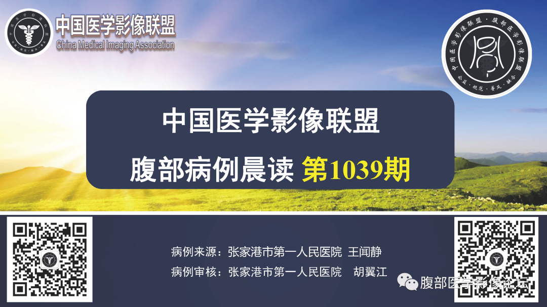 影像PPT - 【病例】胃神经内分泌癌1例CT影像-1