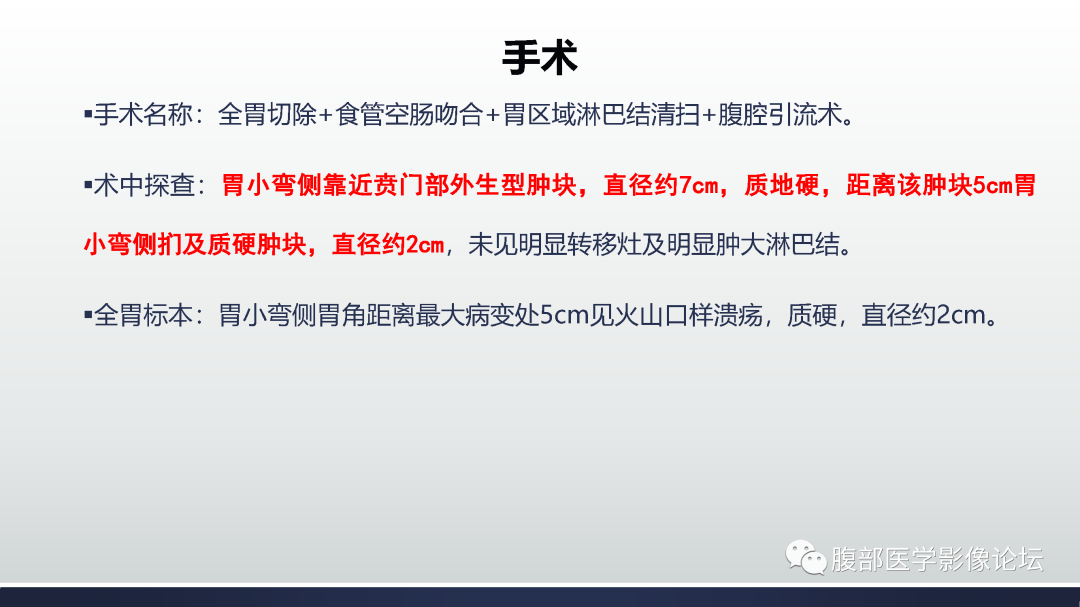 影像PPT - 【病例】胃神经内分泌癌1例CT影像-17