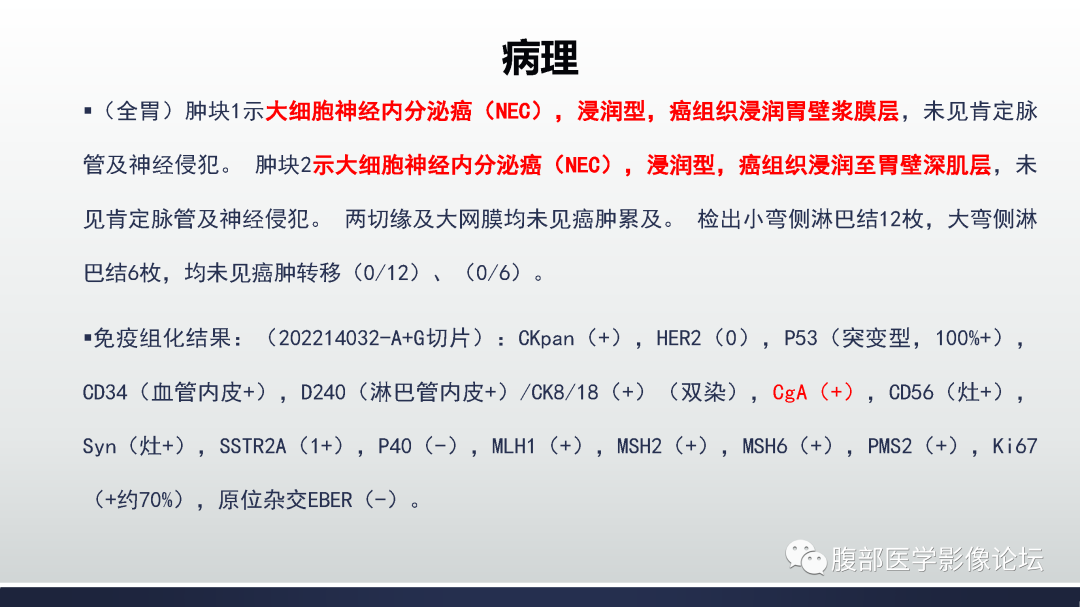 影像PPT - 【病例】胃神经内分泌癌1例CT影像-18