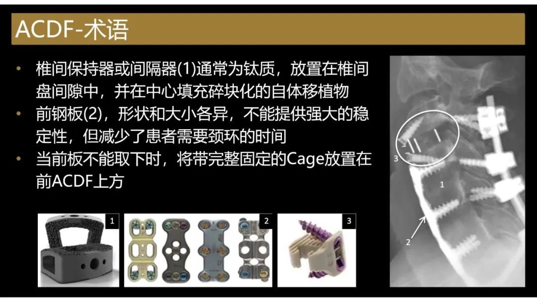 影像PPT - 【PPT】评估围手术期脊柱:除了退行性椎间盘疾病和金属植入物的并发症外-15