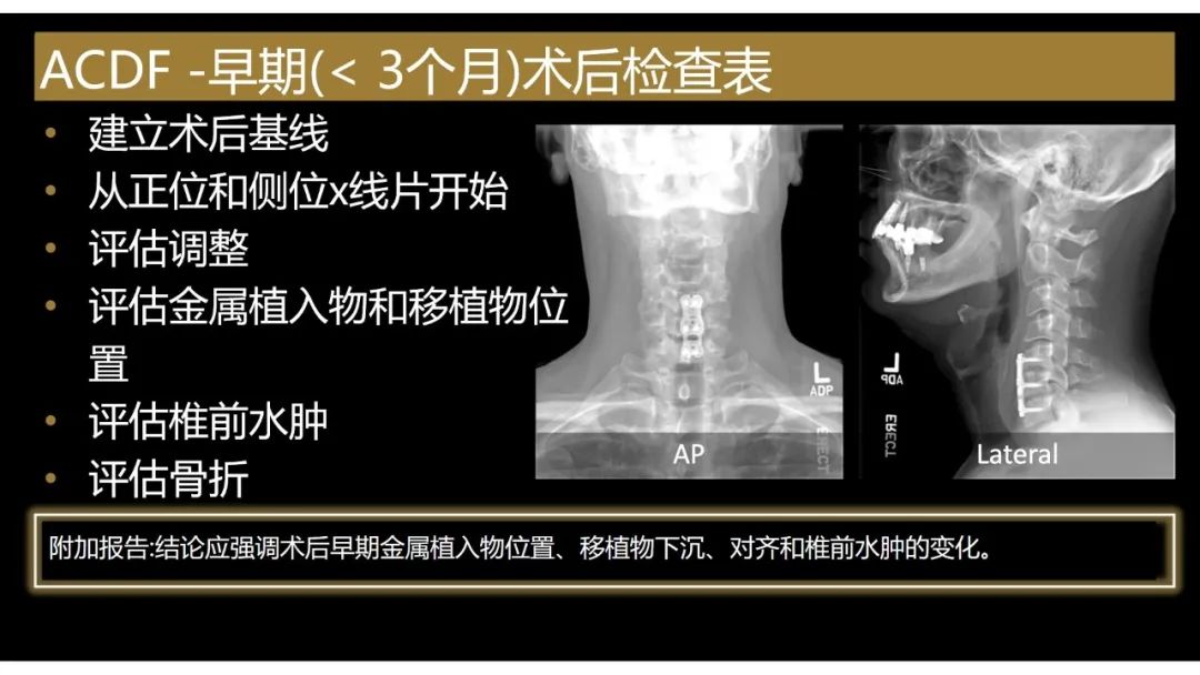影像PPT - 【PPT】评估围手术期脊柱:除了退行性椎间盘疾病和金属植入物的并发症外-19