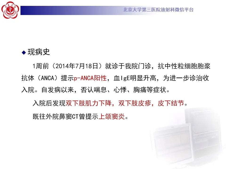影像PPT - 【PPT】嗜酸性肉芽肿性多血管炎-4