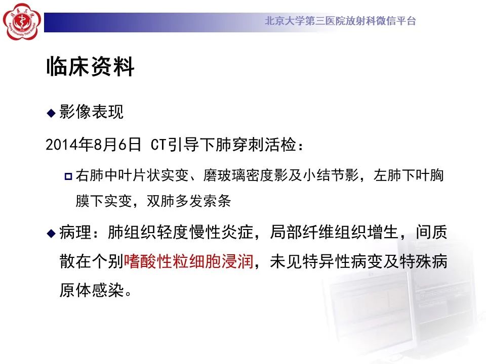 影像PPT - 【PPT】嗜酸性肉芽肿性多血管炎-9