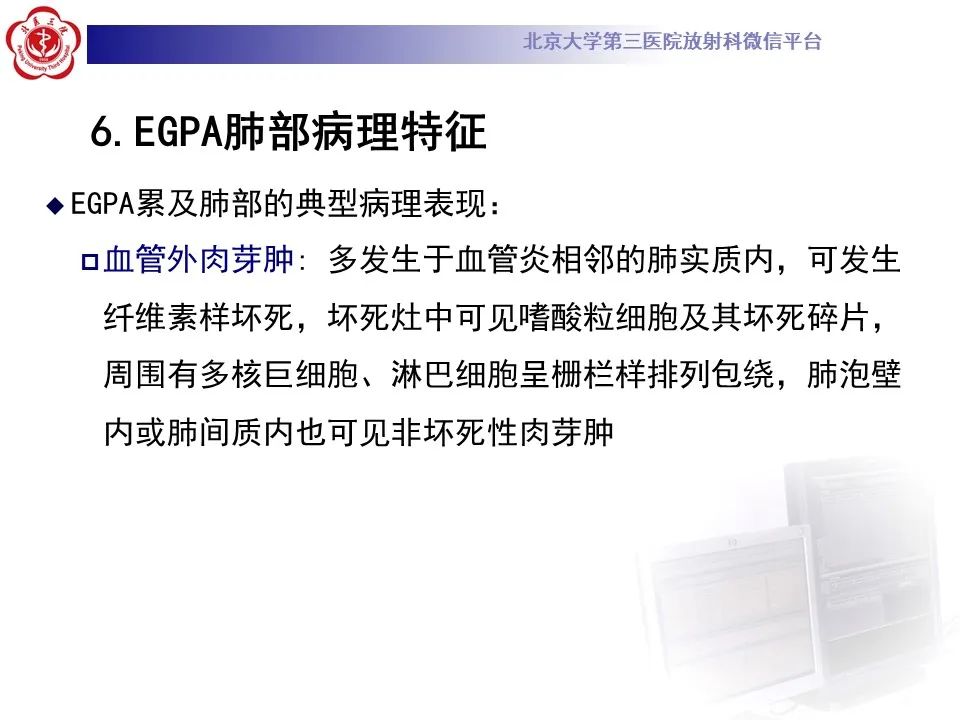 影像PPT - 【PPT】嗜酸性肉芽肿性多血管炎-21