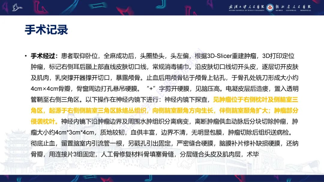 影像PPT - 【PPT】侧脑室肿瘤影像诊断-5