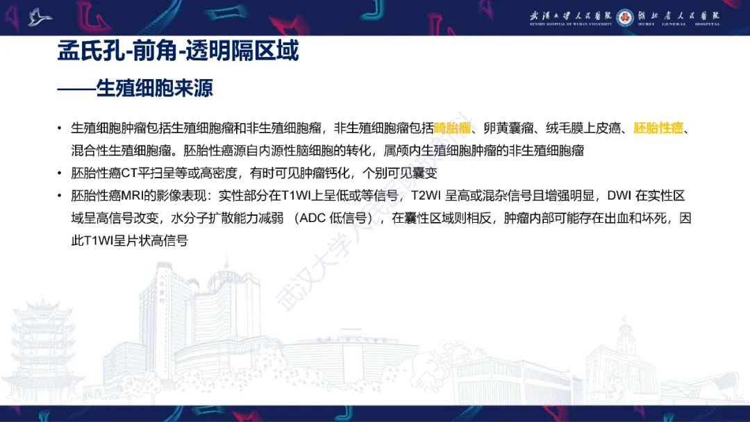 影像PPT - 【PPT】侧脑室肿瘤影像诊断-21