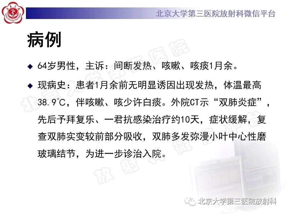 影像PPT - 【PPT】过敏性肺炎-2