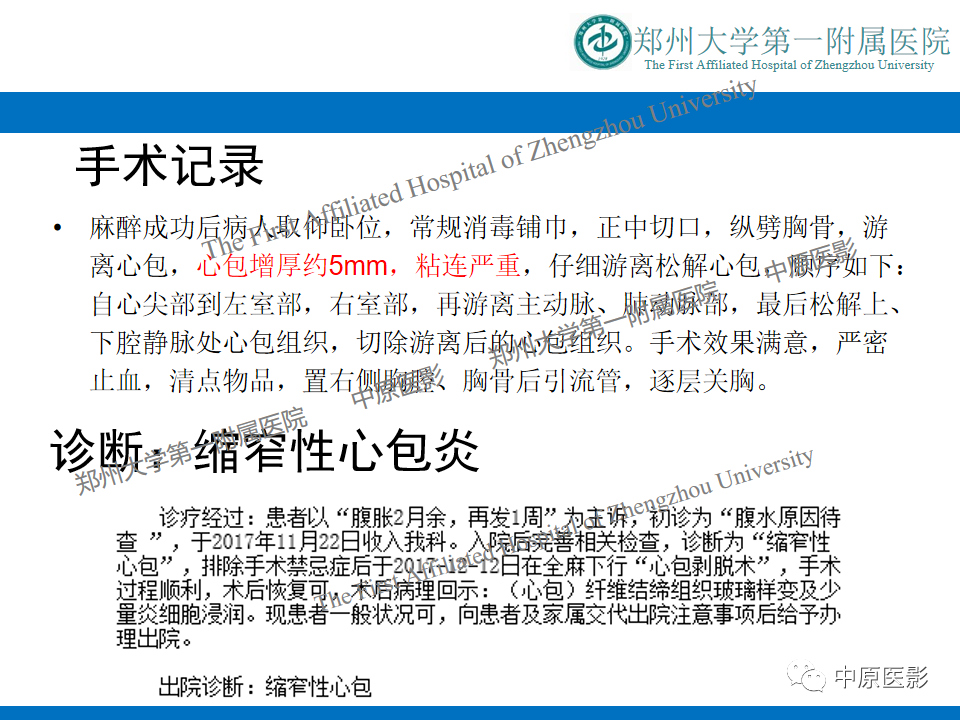 影像PPT - 【病例】缩窄性心包炎1例MR影像-9