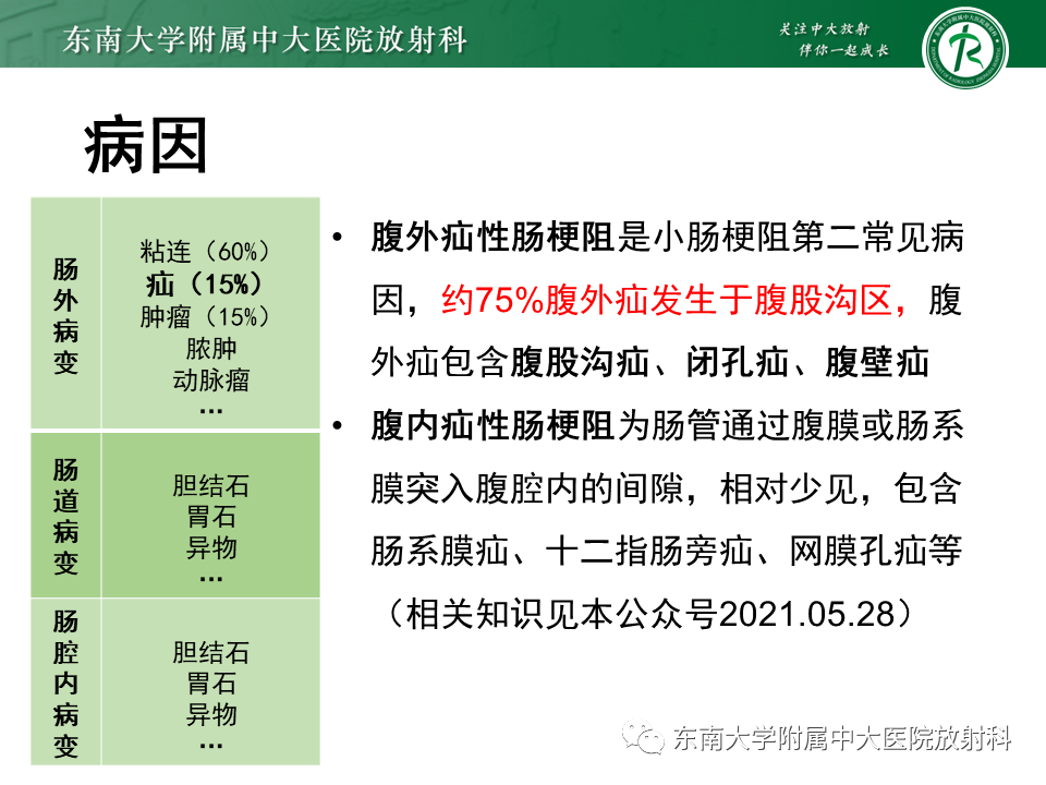 影像PPT - 【PPT】小肠梗阻的影像诊断-9