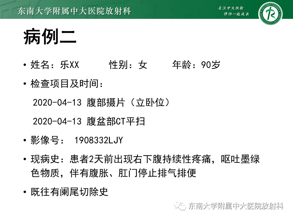 影像PPT - 【PPT】小肠梗阻的影像诊断-10