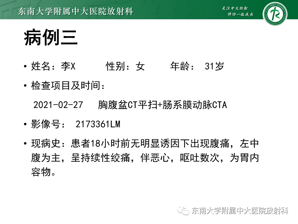 影像PPT - 【PPT】小肠梗阻的影像诊断-13