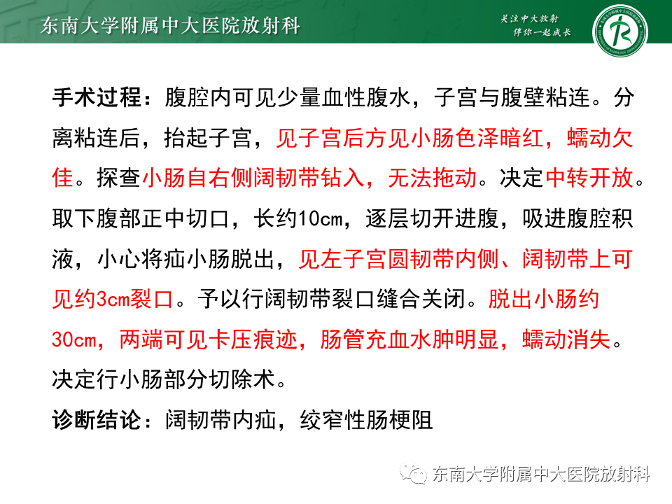 影像PPT - 【PPT】小肠梗阻的影像诊断-15