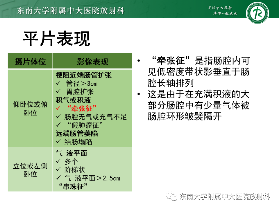 影像PPT - 【PPT】小肠梗阻的影像诊断-24