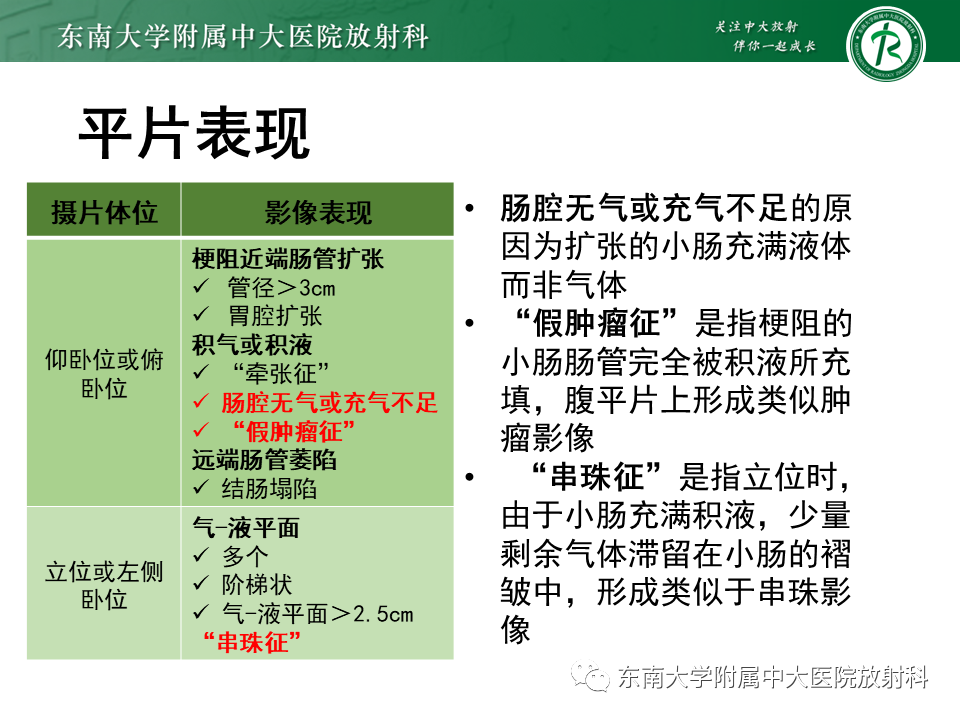 影像PPT - 【PPT】小肠梗阻的影像诊断-26