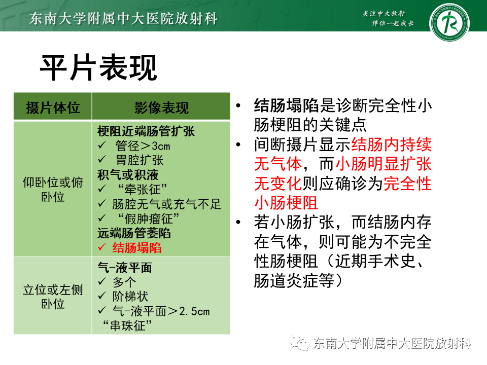 影像PPT - 【PPT】小肠梗阻的影像诊断-28
