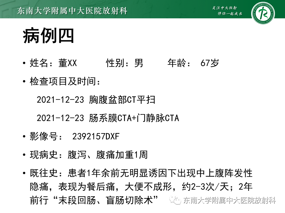 影像PPT - 【PPT】小肠梗阻的影像诊断-35
