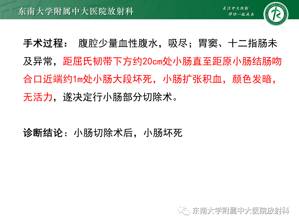 影像PPT - 【PPT】小肠梗阻的影像诊断-37
