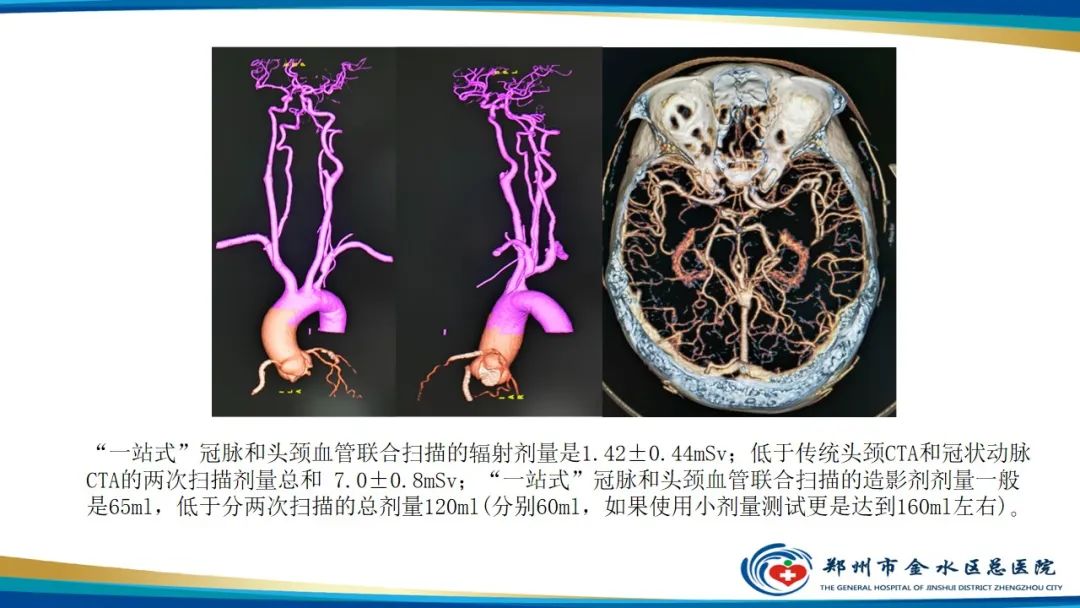 影像PPT - 【PPT】冠脉头颈一站式CTA联合扫描技术-4