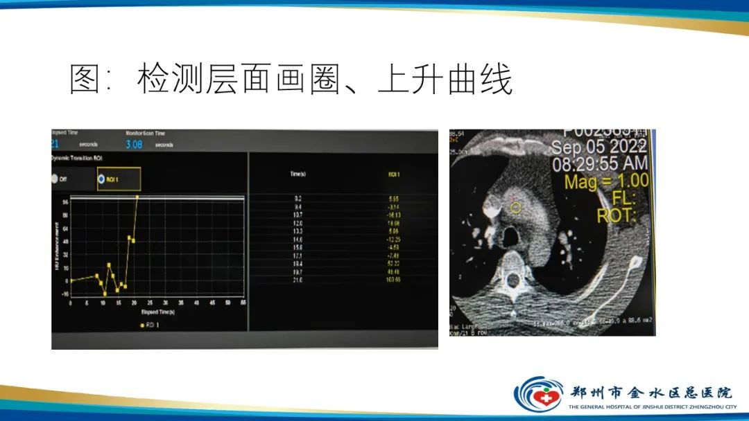 影像PPT - 【PPT】冠脉头颈一站式CTA联合扫描技术-24