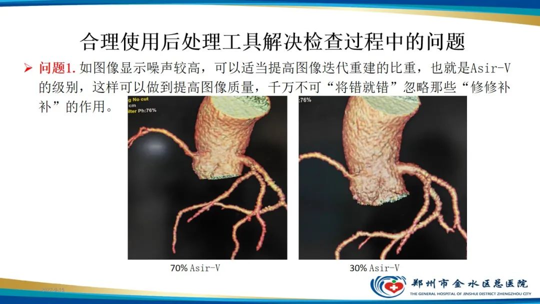 影像PPT - 【PPT】冠脉头颈一站式CTA联合扫描技术-28