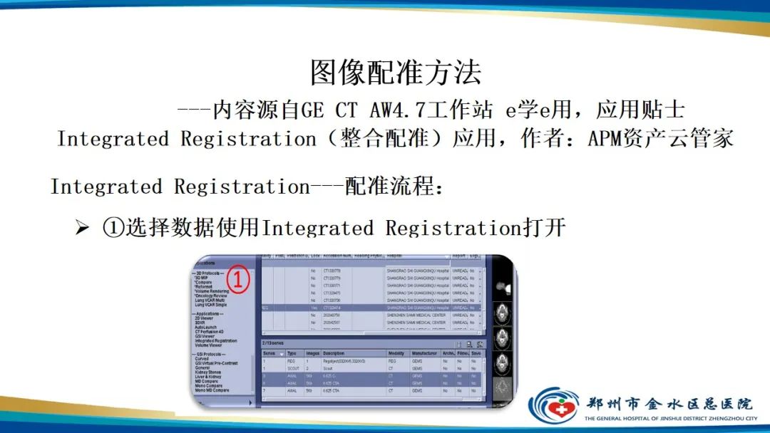 影像PPT - 【PPT】冠脉头颈一站式CTA联合扫描技术-31