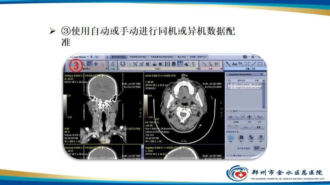 影像PPT - 【PPT】冠脉头颈一站式CTA联合扫描技术-33