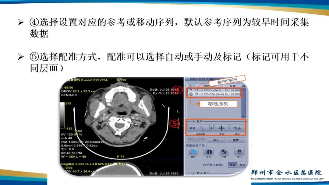 影像PPT - 【PPT】冠脉头颈一站式CTA联合扫描技术-34
