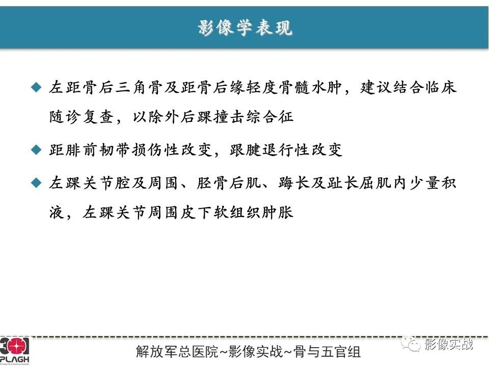 影像PPT - 【病例】后踝撞击综合征1例MR影像-7