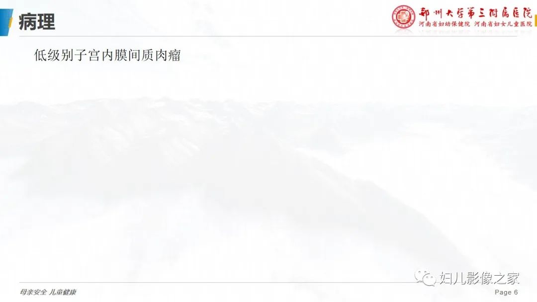 影像PPT - 【PPT】子宫内膜间质肉瘤的影像诊断-6