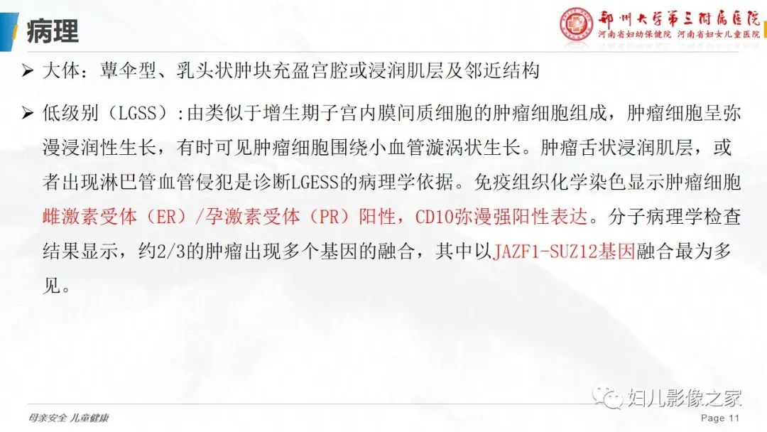 影像PPT - 【PPT】子宫内膜间质肉瘤的影像诊断-11