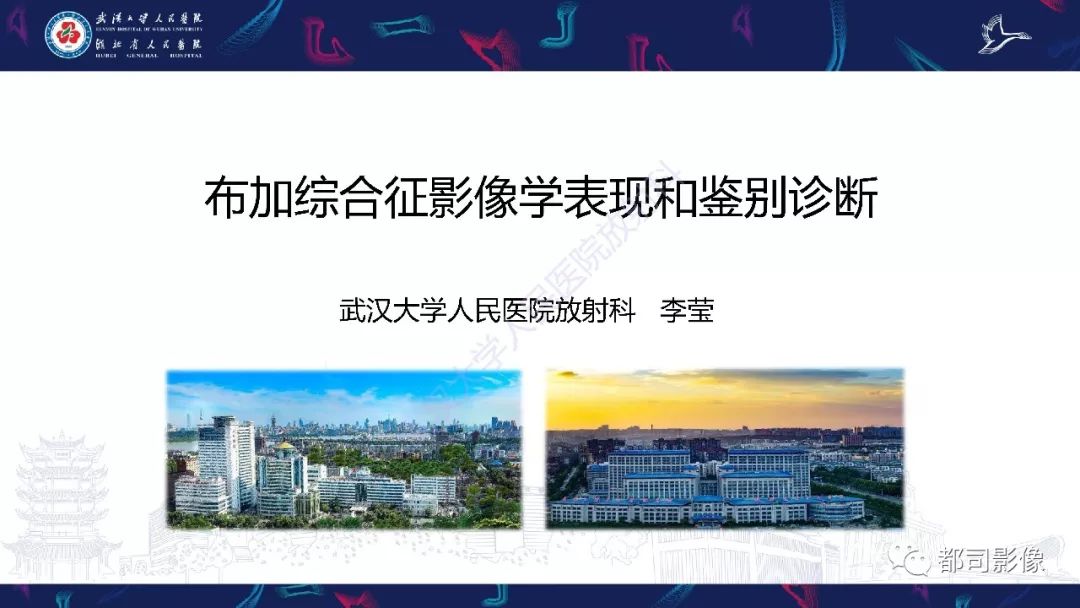 影像PPT - 【PPT】布加综合征影像学表现和鉴别诊断-1