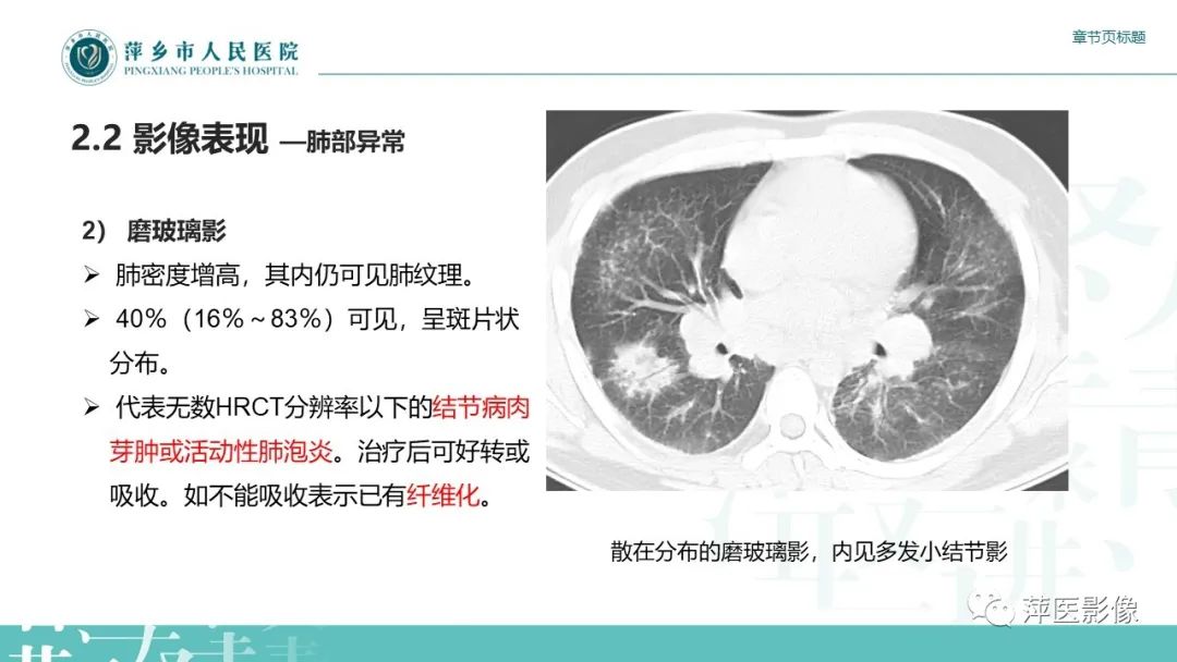 影像PPT - 【PPT】肺结节病-12